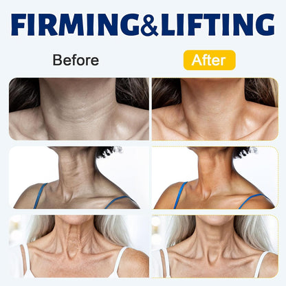 FirmLift Neck Tightening Cream